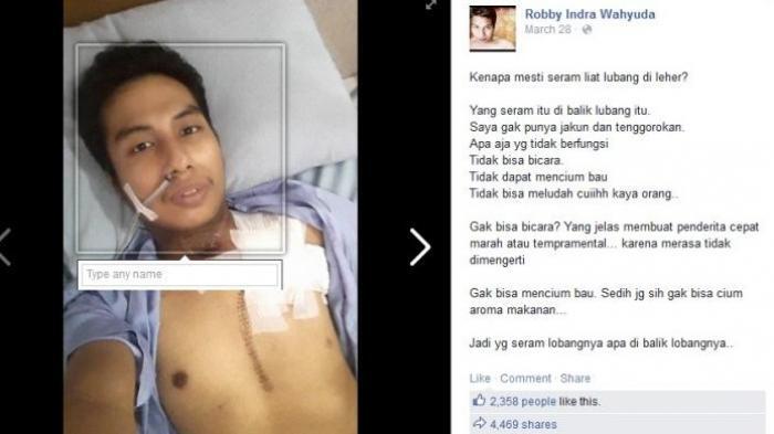 Robby, Pria yang Kehilangan Jakun karena Merokok Dikabarkan Meninggal