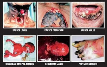 Teguran bagi Perokok Generasi Muda (URGENT, tolong bantu tugas UAS ane guys..)