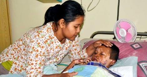 Kisah Tragis Bocah Sukoharjo Yang Disiram Spiritus Oleh Temannya