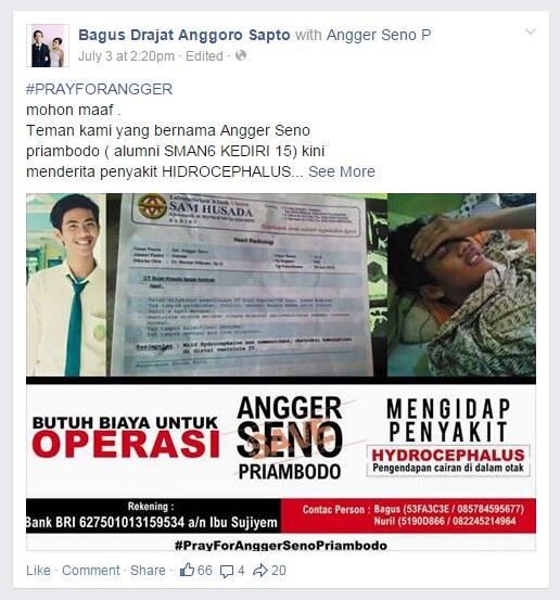 &#91;NEED HELP&#93; Temen Ane Butuh Biaya Buat Operasi Hydrocephalus