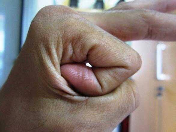 Ayo Dicoba Gan!!! Begini Cara Atasi Mata Minus dengan Jari Tangan