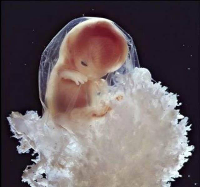 Foto-Foto Proses terjadinya janis bayi manusia 