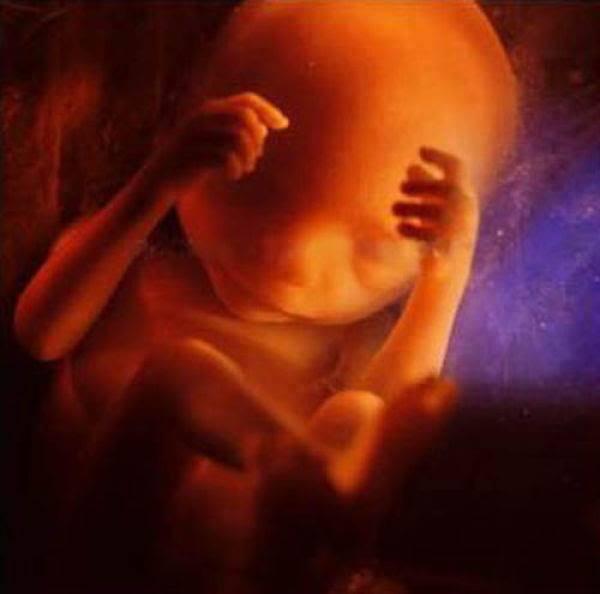 Foto-Foto Proses terjadinya janis bayi manusia 