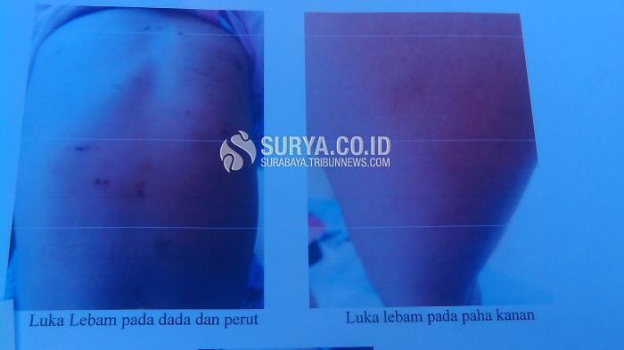 &#91;NEXT ANGELINE&#93; Ditinggal Mati Ibunya, Alifa Dapat Penganiyaan Keras dari Bibinya