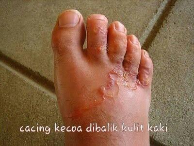 Jangan pukul atau injak kecoa!