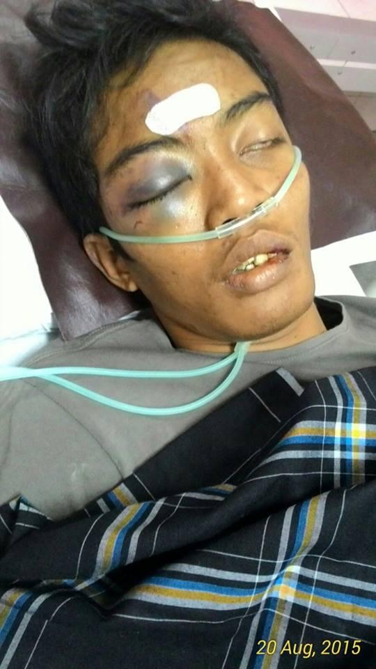 Korban salah tangkap kampung PULO babak belur dihajar satpol PP sampe koma