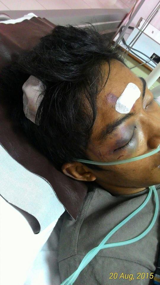 Korban salah tangkap kampung PULO babak belur dihajar satpol PP sampe koma