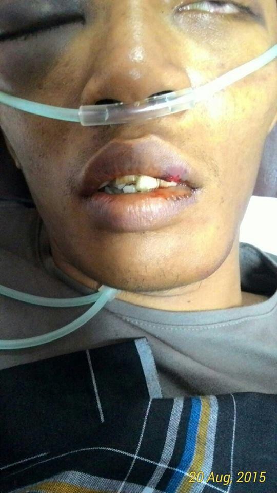 Korban salah tangkap kampung PULO babak belur dihajar satpol PP sampe koma
