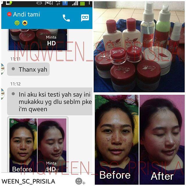 TESTI MEMAKAI PRODUK IM QWEEN SKINCARE