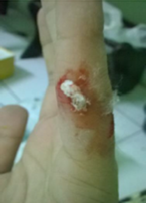 Manfaat menarik dan tak biasa dari bawang putih yang perlu kamu tahu