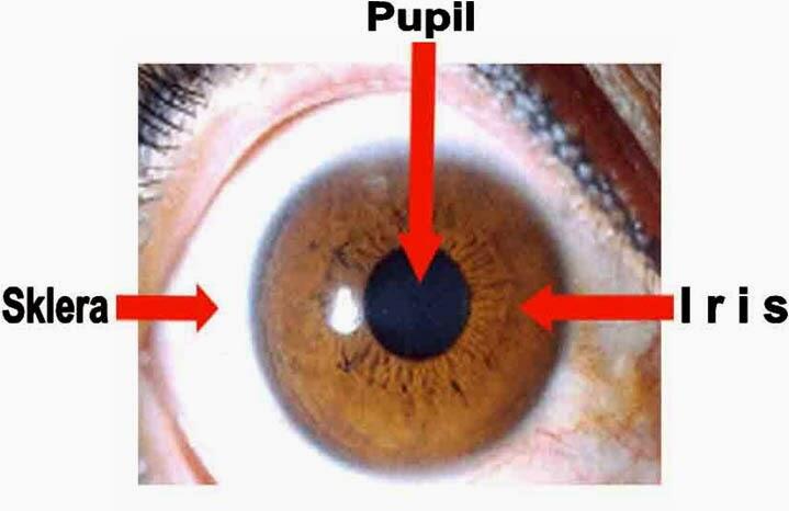 Cara Mendeteksi Gejala Jenis Penyakit Lewat Pada Iris Mata