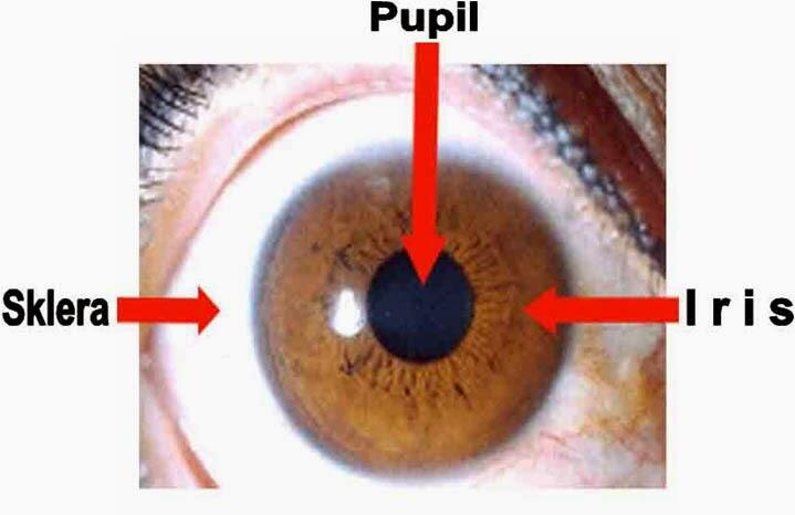 Cara Mendeteksi Gejala Jenis  Penyakit Lewat Pada Iris  Mata  