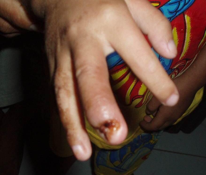 (HOT) INOVASI DALAM PENYEMBUHAN HIV AIDS
