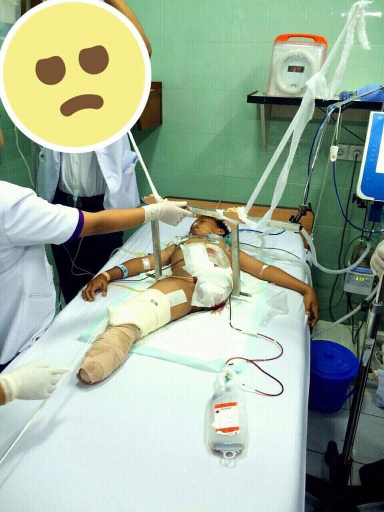 Mohon bantuan pengobatan bocah malang ini.. :'( 