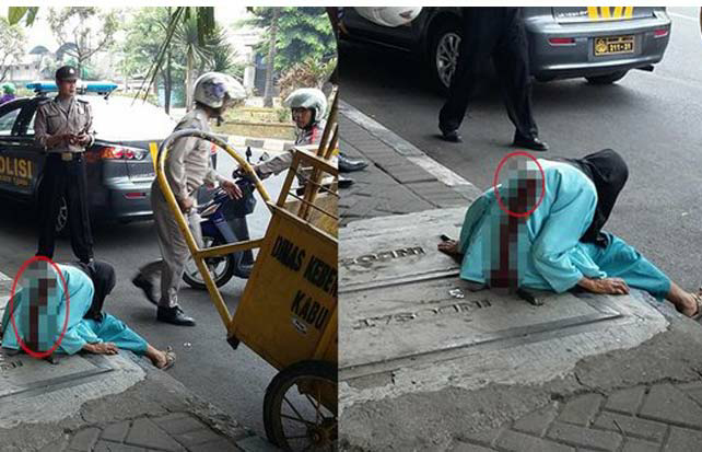 Duh… Nenek Ini Berjalan dengan Pisau Menancap di Punggung