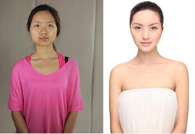 Whoa! Foto-Foto Wanita China Jalani Operasi Plastik Bikin Shock