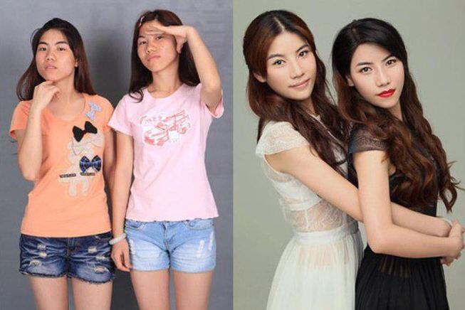 Whoa! Foto-Foto Wanita China Jalani Operasi Plastik Bikin Shock