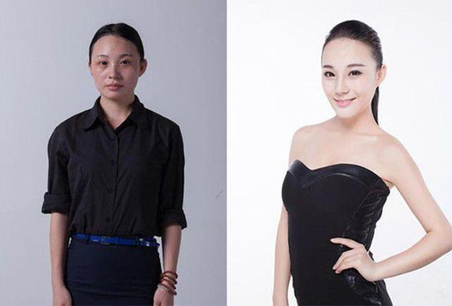 Whoa! Foto-Foto Wanita China Jalani Operasi Plastik Bikin Shock