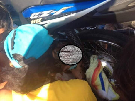 Karena Selendang Terjerat Rantai, Bayi Ini Ketarik dan Kejepit Roda Belakang