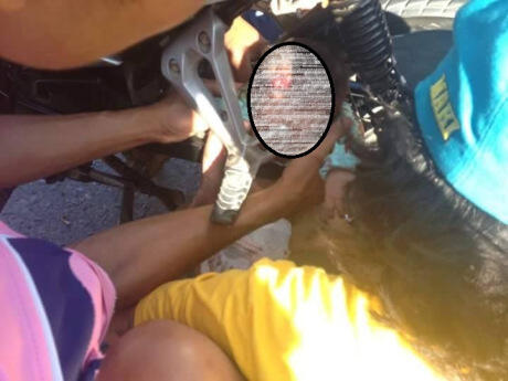 Karena Selendang Terjerat Rantai, Bayi Ini Ketarik dan Kejepit Roda Belakang