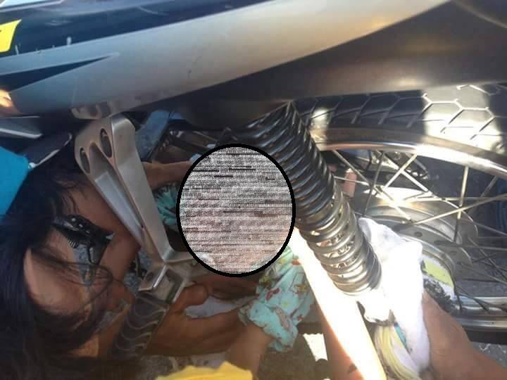 Karena Selendang Terjerat Rantai, Bayi Ini Ketarik dan Kejepit Roda Belakang
