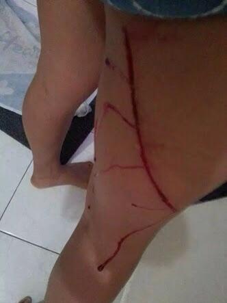 Pria Diduga Pelaku Penyayatan Paha Berhasil Ditangkap Petugas