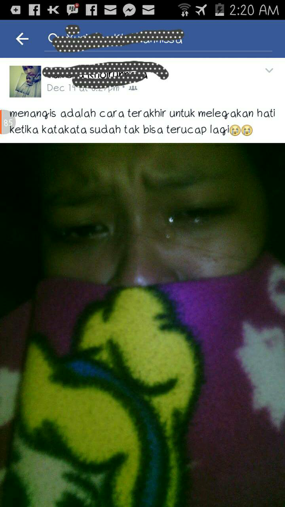 SEREM gan. akibat GILA SELFIE bibir wanita ini jadi MONYONG