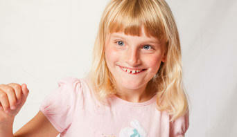 anak sering senyum&amp;ketawa?WASPADA angelman syndrome