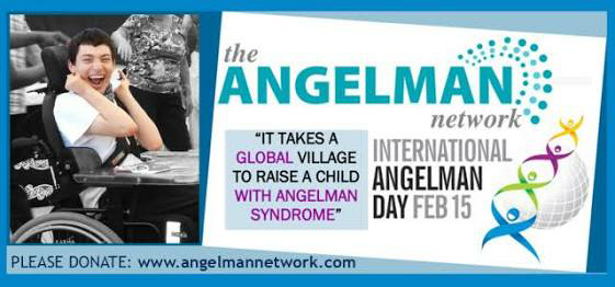 anak sering senyum&amp;ketawa?WASPADA angelman syndrome