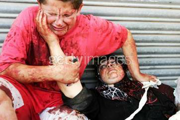 &#91;Kisah Nyata Dipalestina&#93; Bundaku. Jangan Pergi.‼