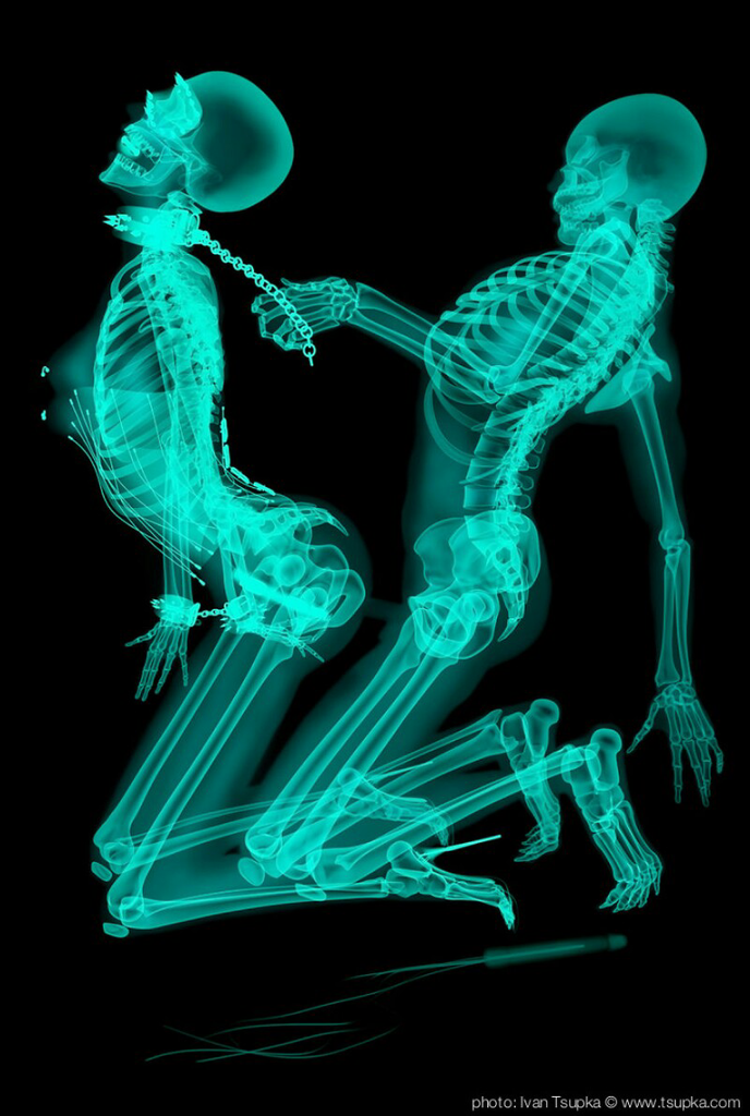Keren, Sinar X-Ray Bisa Jadi Seni Juga, Gans! &#91;Usia 21+&#93;
