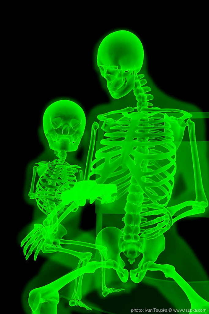 Keren, Sinar X-Ray Bisa Jadi Seni Juga, Gans! &#91;Usia 21+&#93;