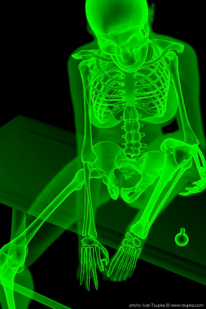 Keren, Sinar X-Ray Bisa Jadi Seni Juga, Gans! &#91;Usia 21+&#93;
