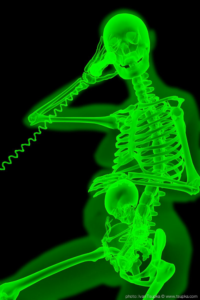 Keren, Sinar X-Ray Bisa Jadi Seni Juga, Gans! &#91;Usia 21+&#93;