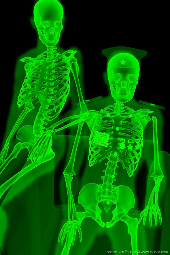 Keren, Sinar X-Ray Bisa Jadi Seni Juga, Gans! &#91;Usia 21+&#93;