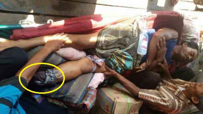 Ada warga potong kaki sendiri saat diserang buaya, pawang dikerahkan