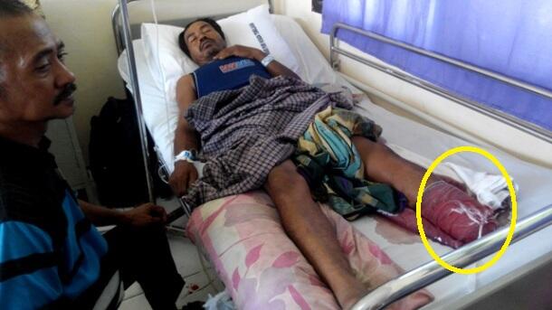 Ada warga potong kaki sendiri saat diserang buaya, pawang dikerahkan
