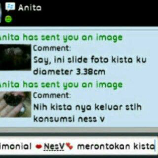 NES-V Minuman Khusus Wanita