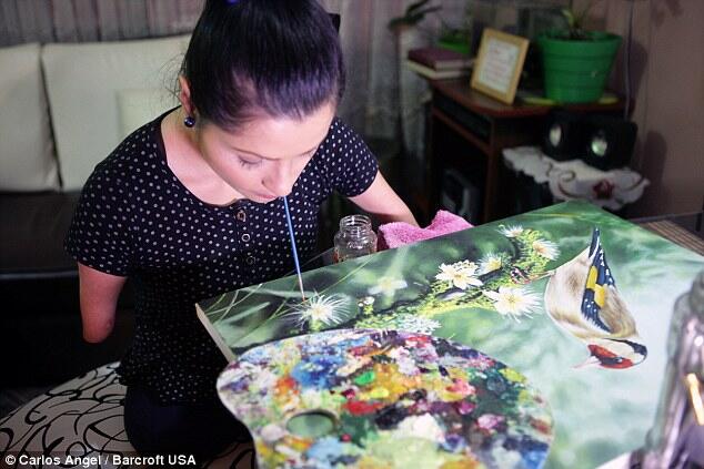 Wanita Tanpa Tangan dan Kaki yang Penuh Inspirasi