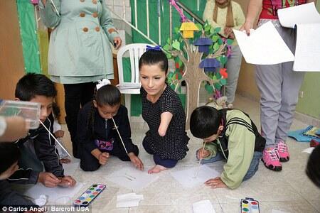 Wanita Tanpa Tangan dan Kaki yang Penuh Inspirasi