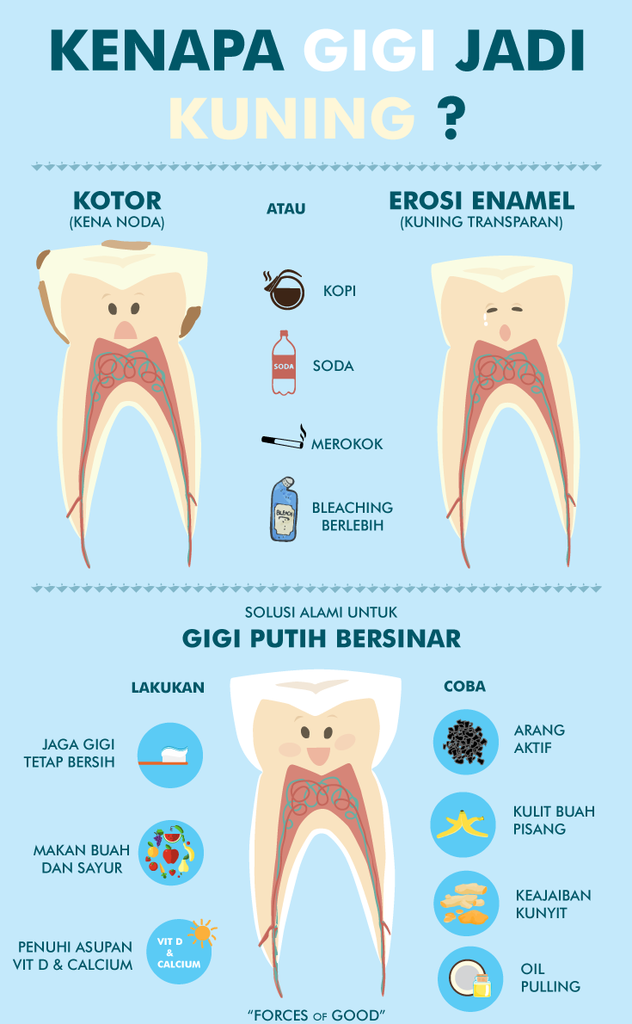 Cara Alami Memutihkan Gigi yang gak Mainstream (A.K.A. Unik)