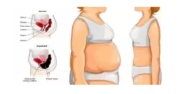 Berat Badan Turun 4 Kilo dalam 3 Hari dengan Diet Militer