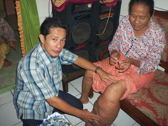 6 Kasus Gigitan Nyamuk dengan Level Berbahaya di Indonesia