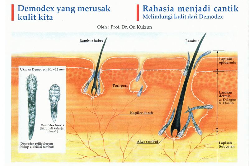** KUTU YANG DAPAT MERUSAK KECANTIKAN DAN KETAMPANAN **