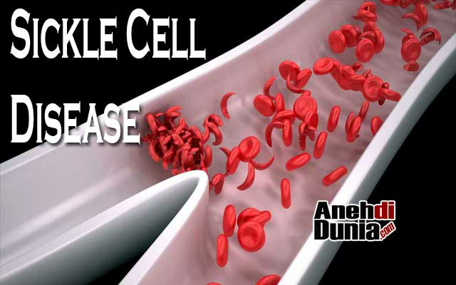 inilah penyakit yang berguna bagi penderita nya.. nah loh