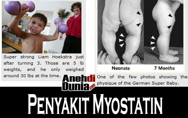 inilah penyakit yang berguna bagi penderita nya.. nah loh