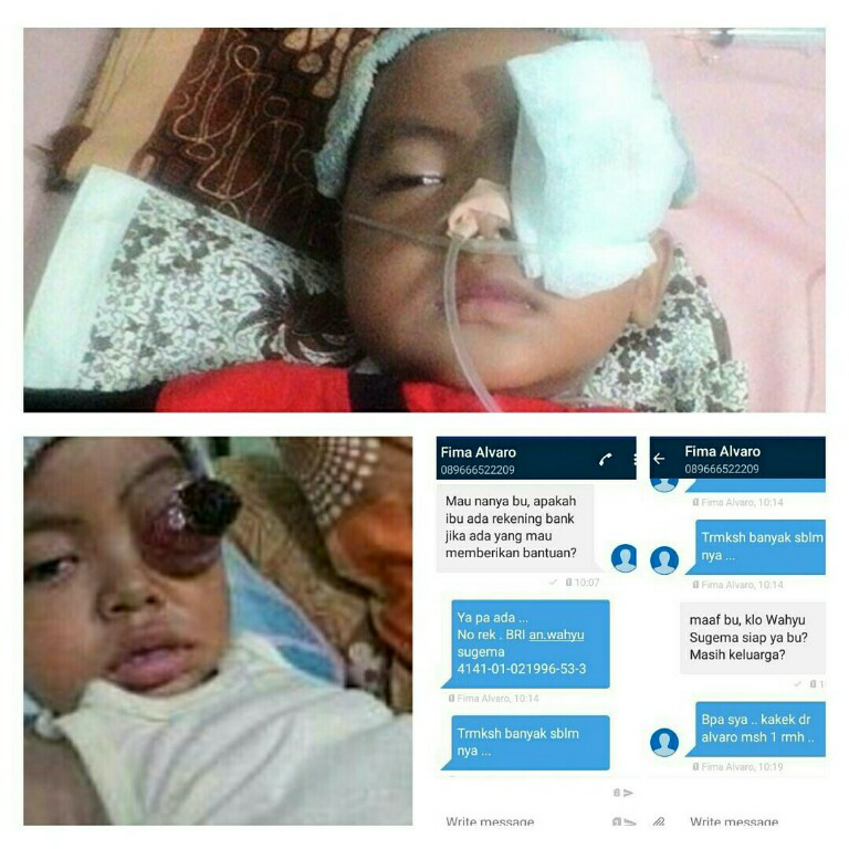 Alvarokhan, anak penderita tumor mata.