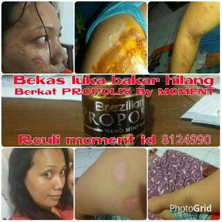 testimoni produk propolis dan bisnisnya