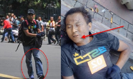 Syuhada Fonda Terus Keluarkan Darah Segar dan Acungkan Jari Tauhid