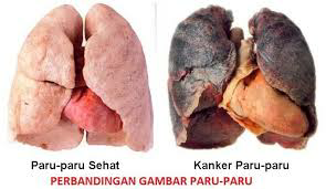 6 penyakit yang paling berbahaya bagi pria!